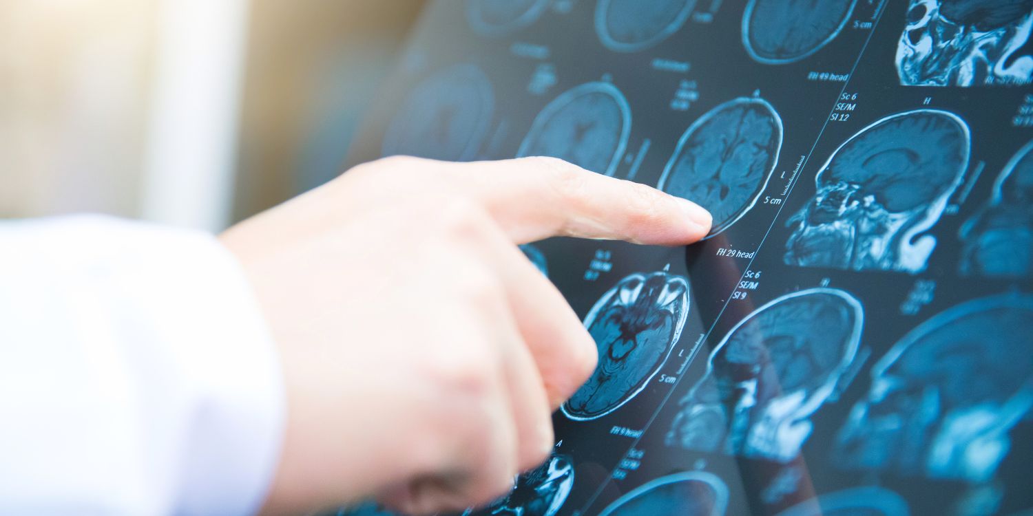 Rezonans Schumanna Odpromiennik